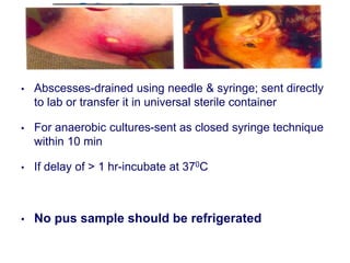 dr bhavika sample collection and transport.ppt