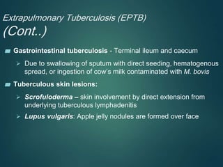 Extrapulmonary Tuberculosis (EPTB)
(Cont..)
▰ Gastrointestinal tuberculosis - Terminal ileum and caecum
 Due to swallowing of sputum with direct seeding, hematogenous
spread, or ingestion of cow’s milk contaminated with M. bovis
▰ Tuberculous skin lesions:
 Scrofuloderma – skin involvement by direct extension from
underlying tuberculous lymphadenitis
 Lupus vulgaris: Apple jelly nodules are formed over face
 