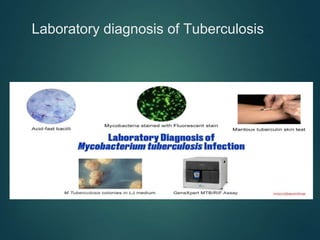Laboratory diagnosis of Tuberculosis
 