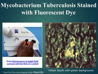 Mycobacterium Tuberculosis Stained
with Fluorescent Dye
From Carl Zeiss microimaging GmbH (FluoLED)
Yellow bacilli with green background.
 