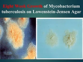 Eight Week Growth of Mycobacterium
tuberculosis on Lowenstein-Jensen Agar
 