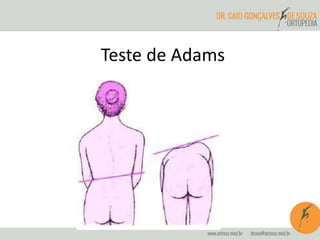 Teste de Adams
 