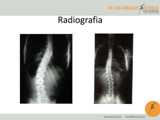 Radiografia
 