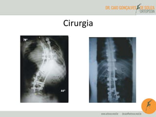Cirurgia
 