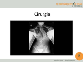 Cirurgia
 
