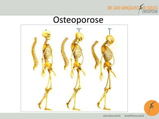Osteoporose
 