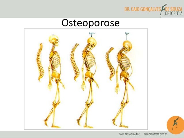 Exame da coluna cervical