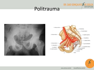 Politrauma
 