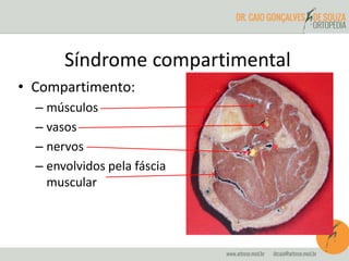 Síndrome compartimental
• Compartimento:
– músculos
– vasos
– nervos
– envolvidos pela fáscia
muscular
 
