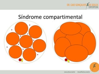 Síndrome compartimental
 
