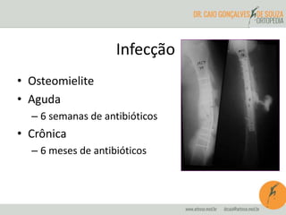 • Osteomielite
• Aguda
– 6 semanas de antibióticos
• Crônica
– 6 meses de antibióticos
Infecção
 