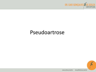 Pseudoartrose
 