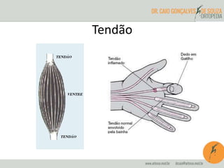 Tendão
 