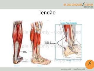 Tendão
 