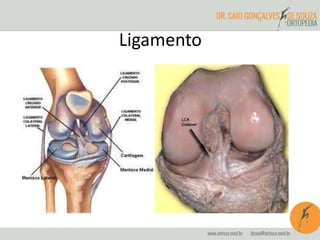 Ligamento
 