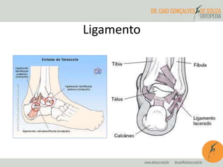 Ligamento
 