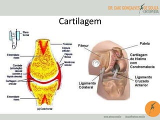 Cartilagem
 
