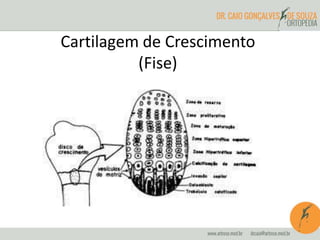 Cartilagem de Crescimento
(Fise)
 