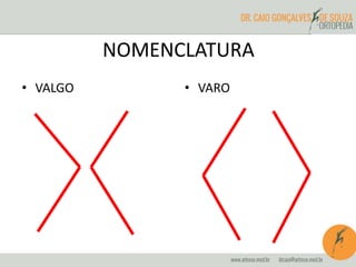 NOMENCLATURA
• VALGO • VARO
 
