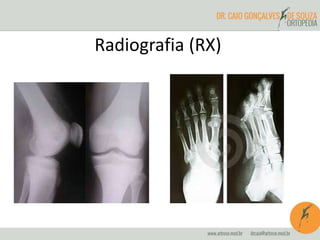 Radiografia (RX)
 