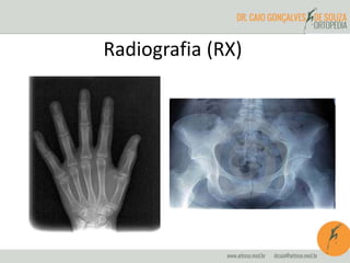 Radiografia (RX)
 