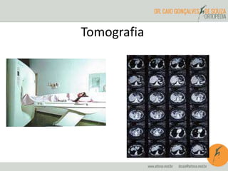 Tomografia
 