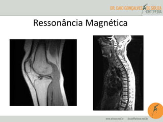 Ressonância Magnética
 