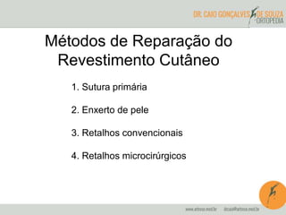 1. Sutura primária
2. Enxerto de pele
3. Retalhos convencionais
4. Retalhos microcirúrgicos
Métodos de Reparação do
Revestimento Cutâneo
 
