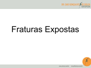 Fraturas Expostas
 