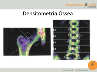 Densitometria Óssea 
 