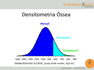 Densitometria Óssea 
 
