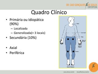Quadro Clínico 
• Primária ou Idiopática 
(90%) 
– Localizada 
– Generalizada(+ 3 locais) 
• Secundária (10%) 
• Axial 
• Periférica 
 