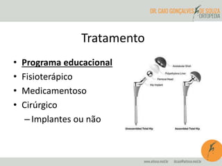 Tratamento 
• Programa educacional 
• Fisioterápico 
• Medicamentoso 
• Cirúrgico 
– Implantes ou não 
 