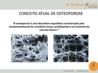 CONCEITO ATUAL DE OSTEOPOROSE 
“A osteoporose é uma desordem esquelética caracterizada pelo 
comprometimento da resistência óssea, predispondo a um aumento do 
Normal 
Osteoporose 
risco de fratura.”1 
 