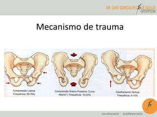 Mecanismo de trauma 
 
