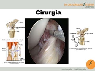 Cirurgia 
 