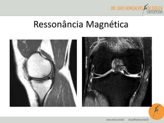 Ressonância Magnética 
 