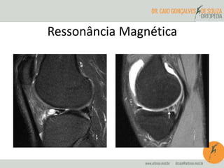 Ressonância Magnética 
 