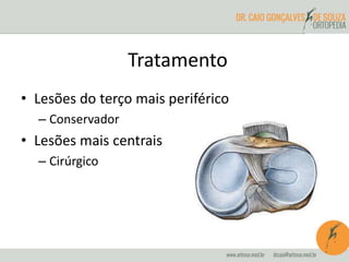 Tratamento 
• Lesões do terço mais periférico 
– Conservador 
• Lesões mais centrais 
– Cirúrgico 
 