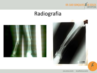 Radiografia 
 