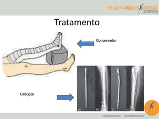 Tratamento 
Conservador 
Cirúrgico 
 