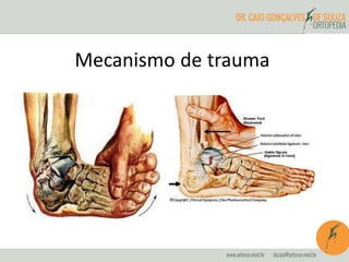 Mecanismo de trauma 
 