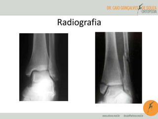 Radiografia 
 