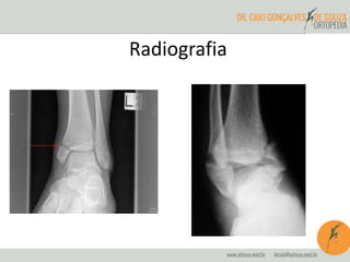 Radiografia 
 