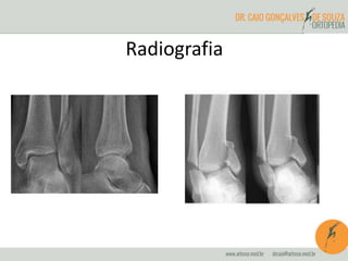 Radiografia 
 