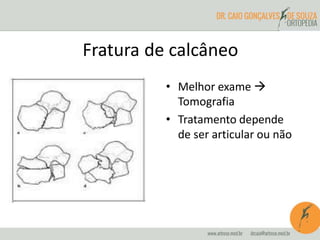 Fratura de calcâneo 
• Melhor exame  
Tomografia 
• Tratamento depende 
de ser articular ou não 
 