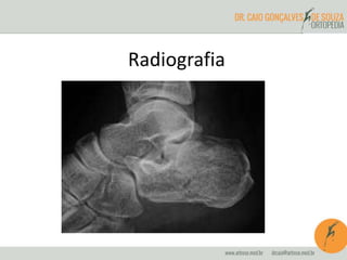 Radiografia 
 