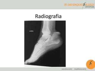 Radiografia 
 