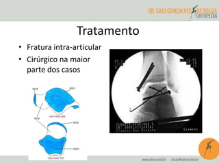 Tratamento 
• Fratura intra-articular 
• Cirúrgico na maior 
parte dos casos 
 