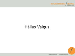 Hállux Valgus 
 
